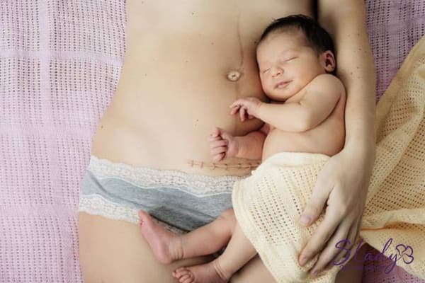 sản hậu gió là gì sản hậu gió là gì