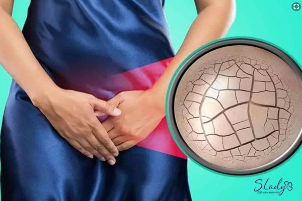 Dấu hiệu khô âm đạo khi bị suy giảm nội tiết tố