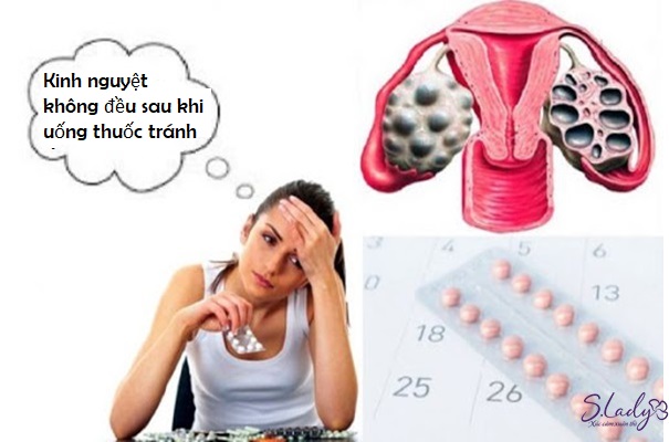 Rất nhiều phụ nữ gặp tình trạng kinh nguyệt không đều do uống thuốc tránh thai